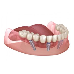 External image link